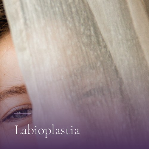 Labioplastia