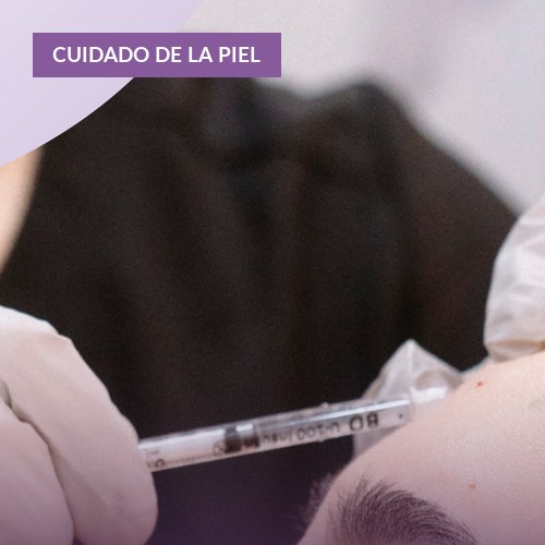 Manchas en la cara: por qué salen y cómo se quitan