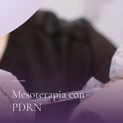 Mesoterapia con PDRN
