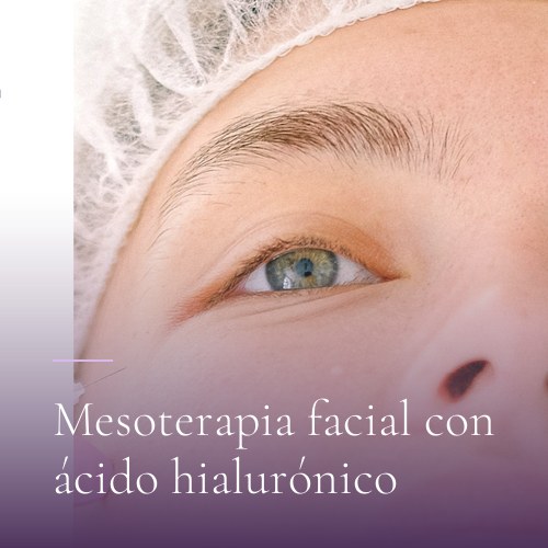 Mesoterapia facial con ácido hialurónico