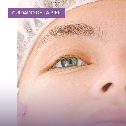 Piel deshidratada: cómo reconocerla y qué hacer