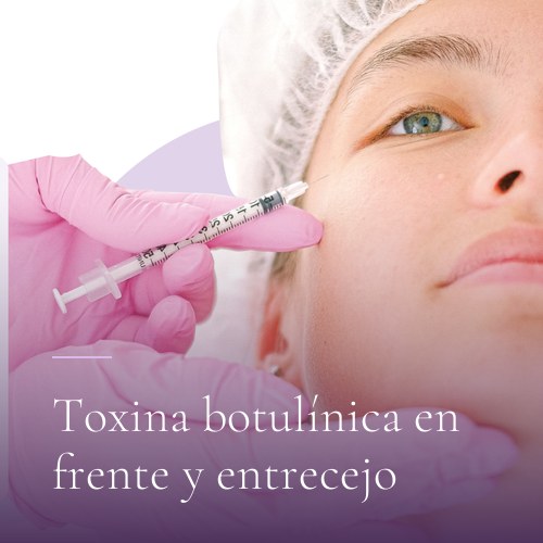 Toxina botulínica en frente y entrecejo